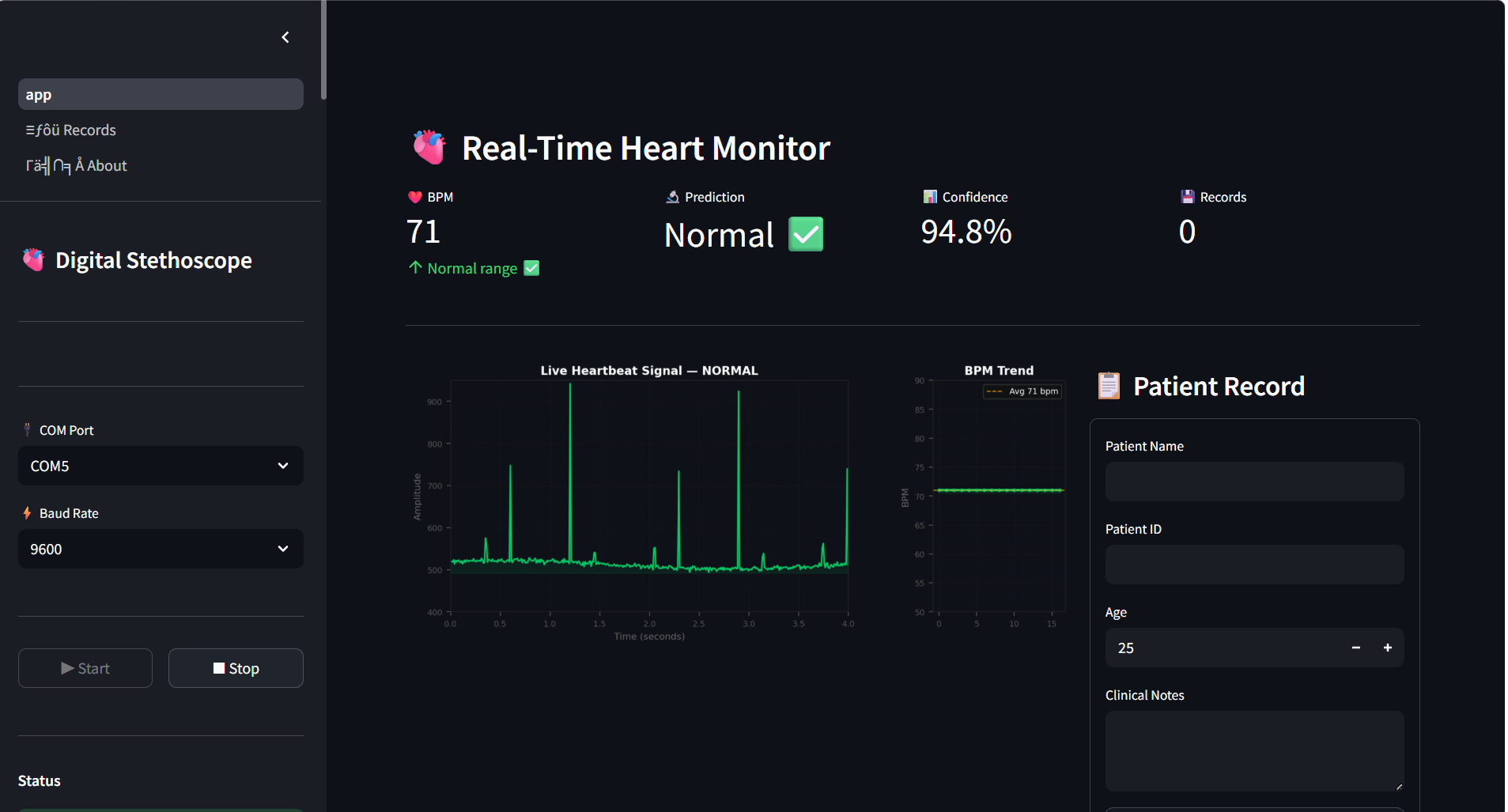 Fig. 4: Streamlit dashboard showing normal heart sound analysis and BPM monitoring.